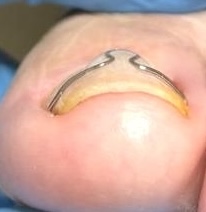 Behandlungsabschluss